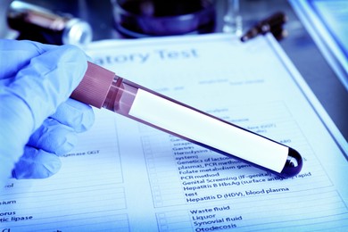 Image of Laboratory worker holding test tube with blood sample over medical form, closeup. Color toned