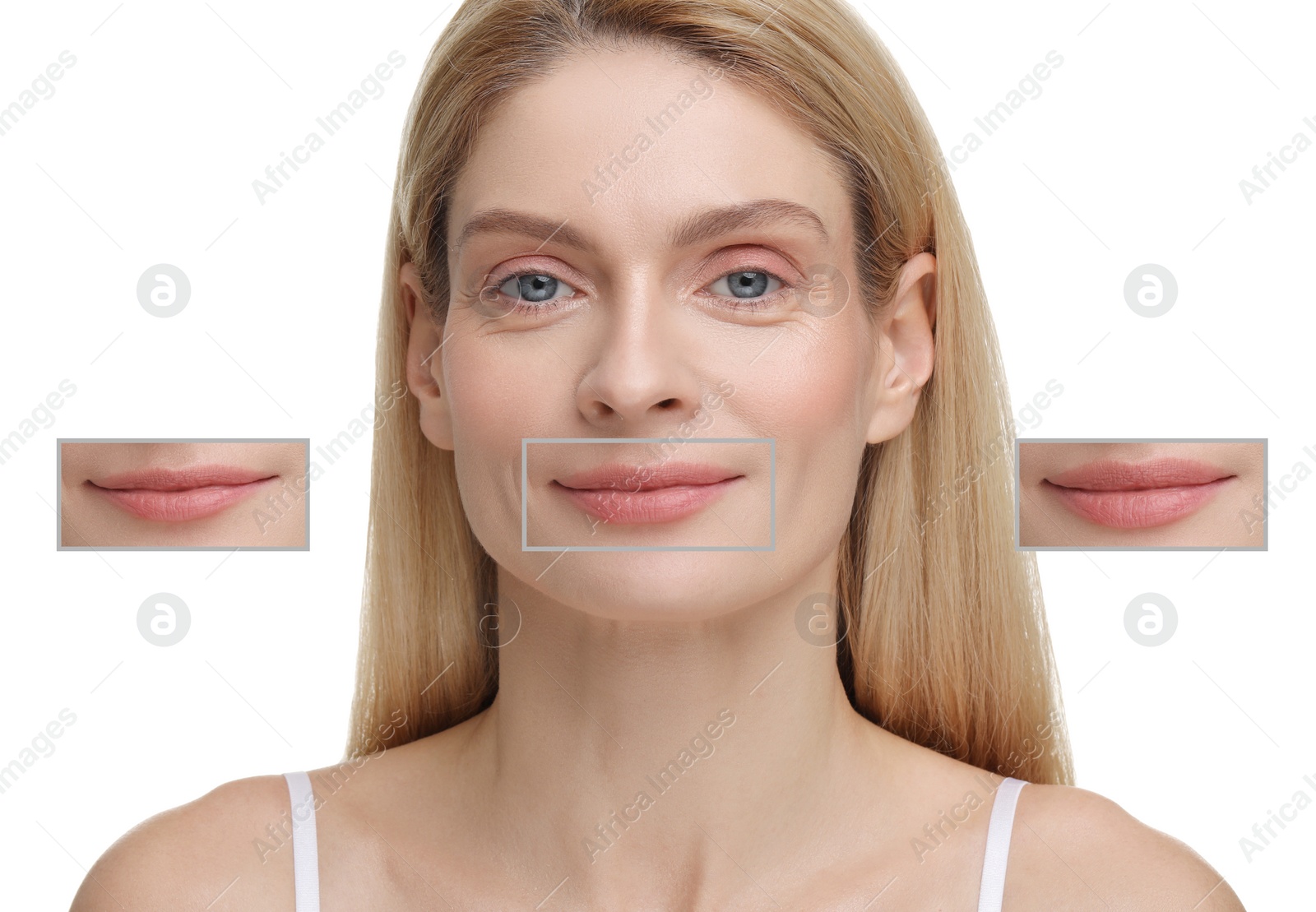 Image of Attractive woman with beautiful lips on white background. Zoomed areas showing difference in lip fullness due to cosmetic procedure