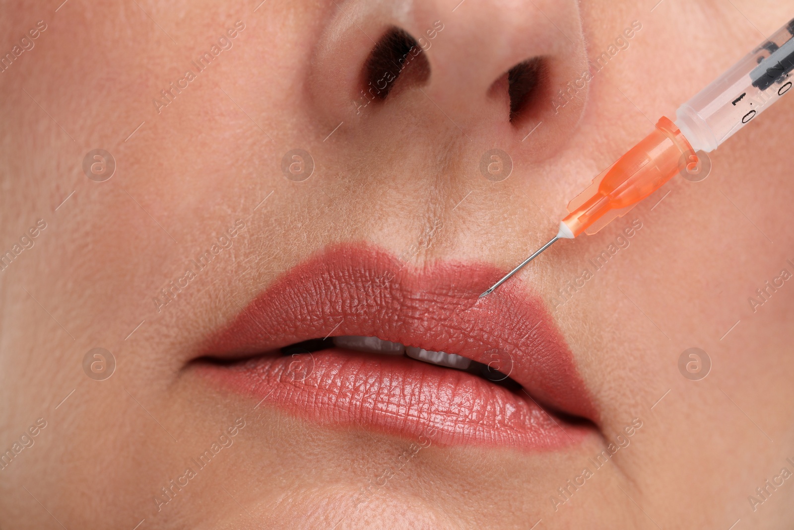 Photo of Senior woman getting lips injection, closeup. Cosmetic surgery