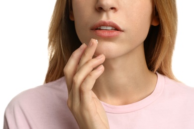 Photo of Woman with herpes applying cream onto lip against white background, closeup