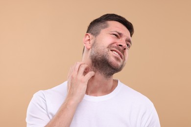 Photo of Allergy symptom. Man scratching his neck on light brown background