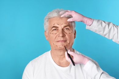 Doctor drawing marks on man's face for cosmetic surgery operation against blue background