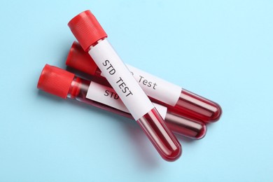 Photo of Tubes with blood samples and labels STD Test on light blue background, flat lay