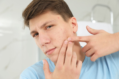 Teen guy with acne problem squeezing pimple in bathroom