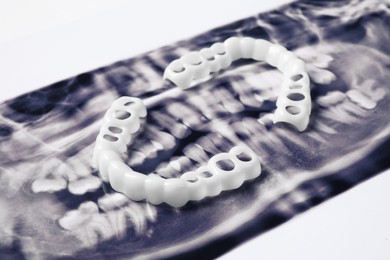 Photo of Mouth guards on dental scan. Bite correction