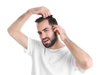 Photo of Young man with hair loss problem on white background