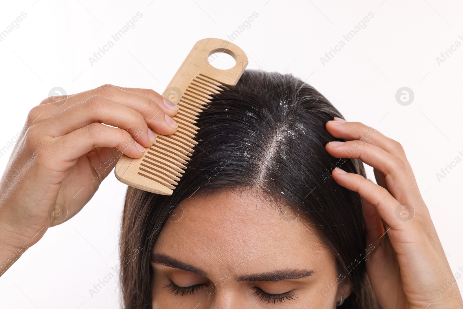 Photo of Woman with comb examining her hair and scalp on white background, closeup. Dandruff problem