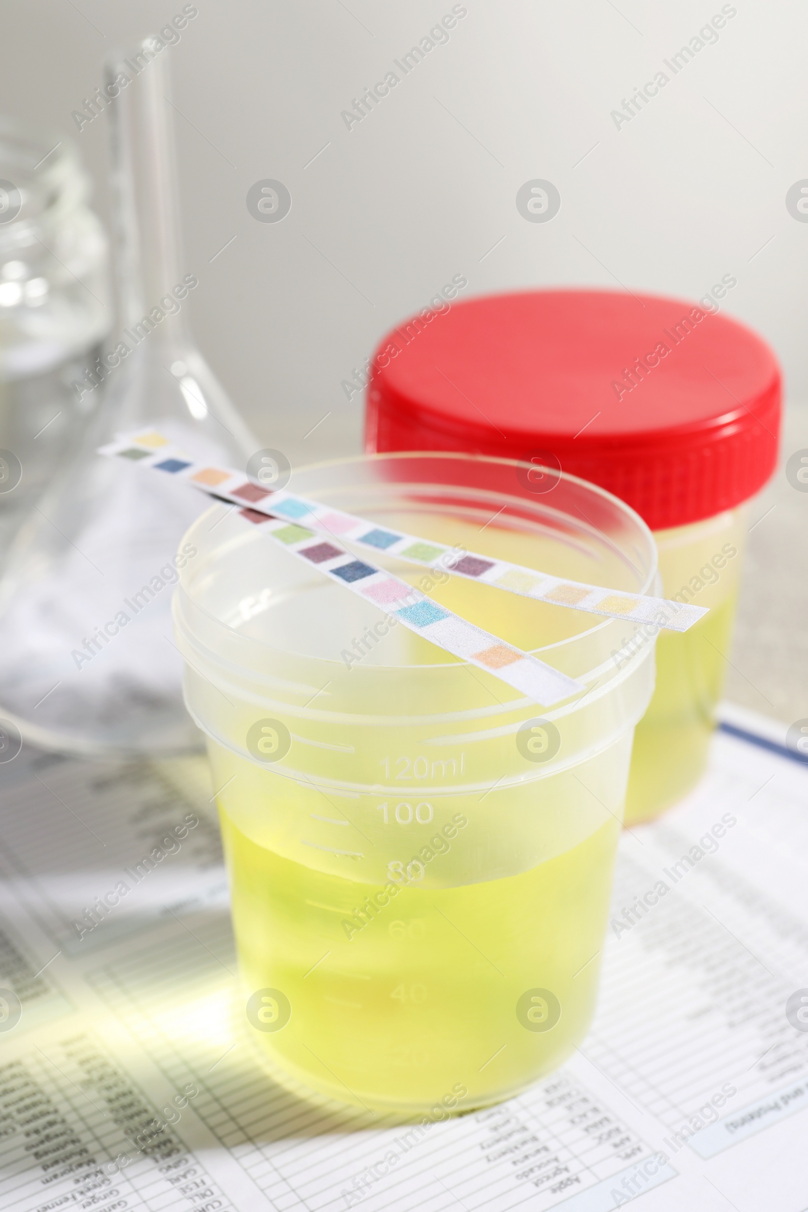 Photo of Containers with urine samples for analysis and glassware on test forms in laboratory