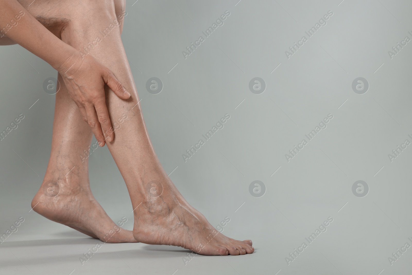 Photo of Closeup view of woman suffering from varicose veins on light grey background. Space for text