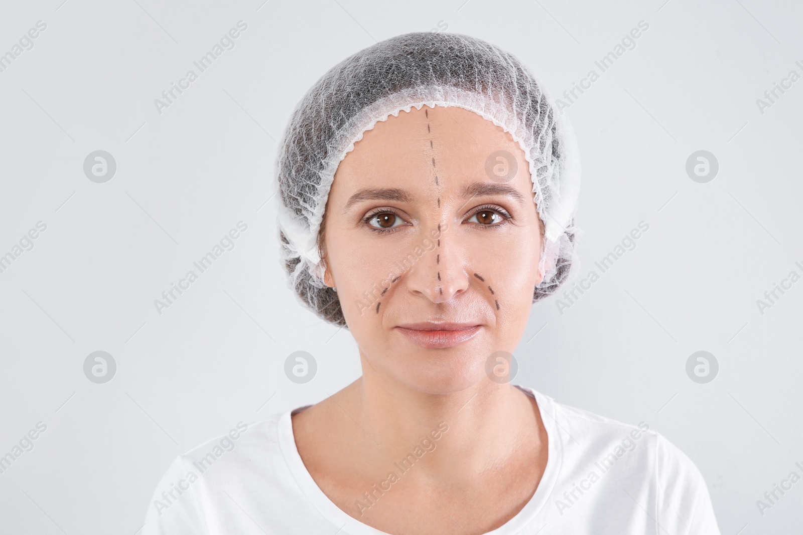 Photo of Portrait of mature woman with marks on face preparing for cosmetic surgery against white background