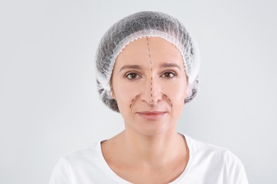 Portrait of mature woman with marks on face preparing for cosmetic surgery against white background