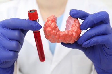 Photo of Endocrinologist showing thyroid gland model and blood sample in test tube, closeup