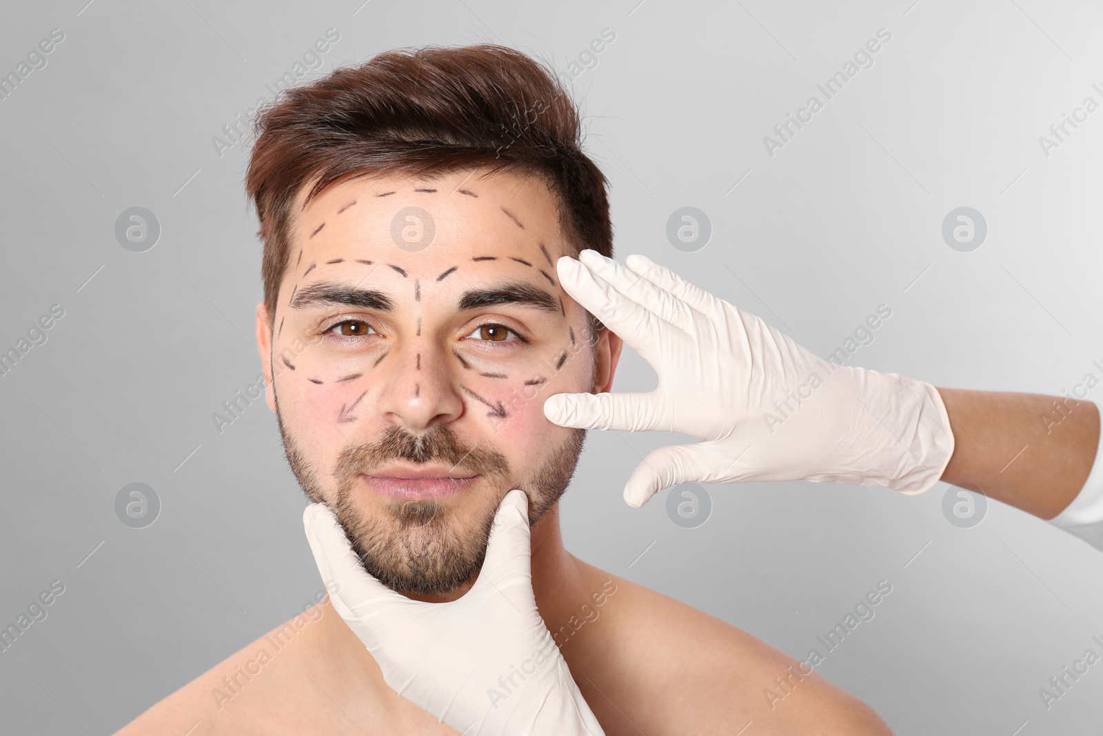 Photo of Doctor examining man's face with marker lines for plastic surgery operation on grey background