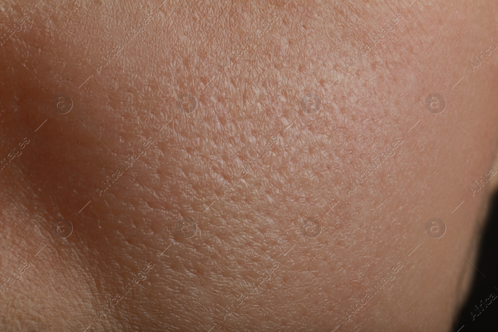 Photo of Closeup view of human skin as background