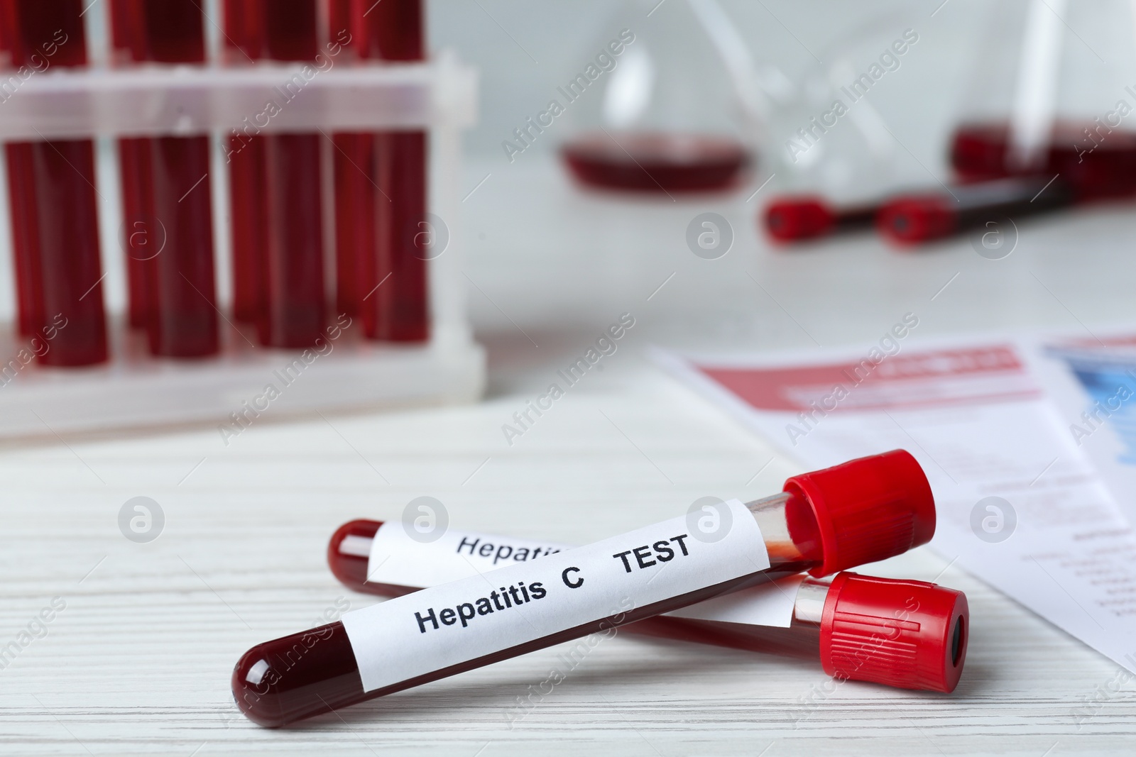 Photo of Tubes with blood samples for hepatitis virus test on white wooden table, closeup