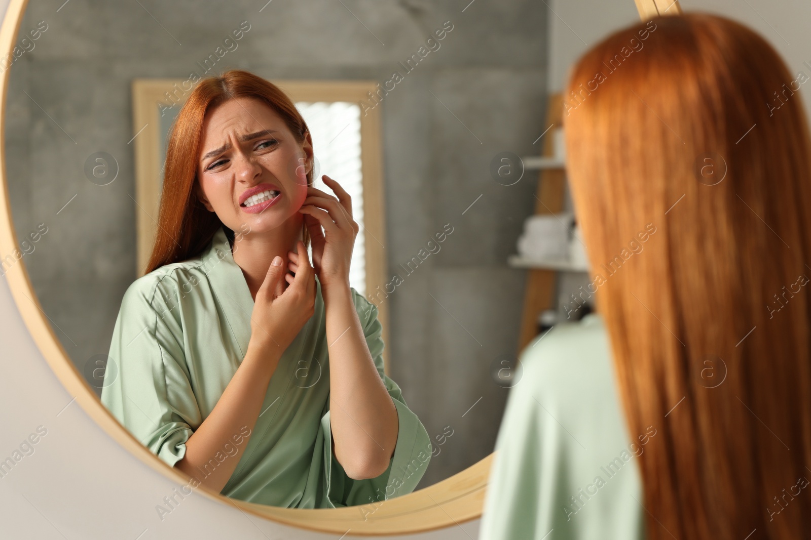 Photo of Suffering from allergy. Young woman scratching her neck near mirror in bathroom