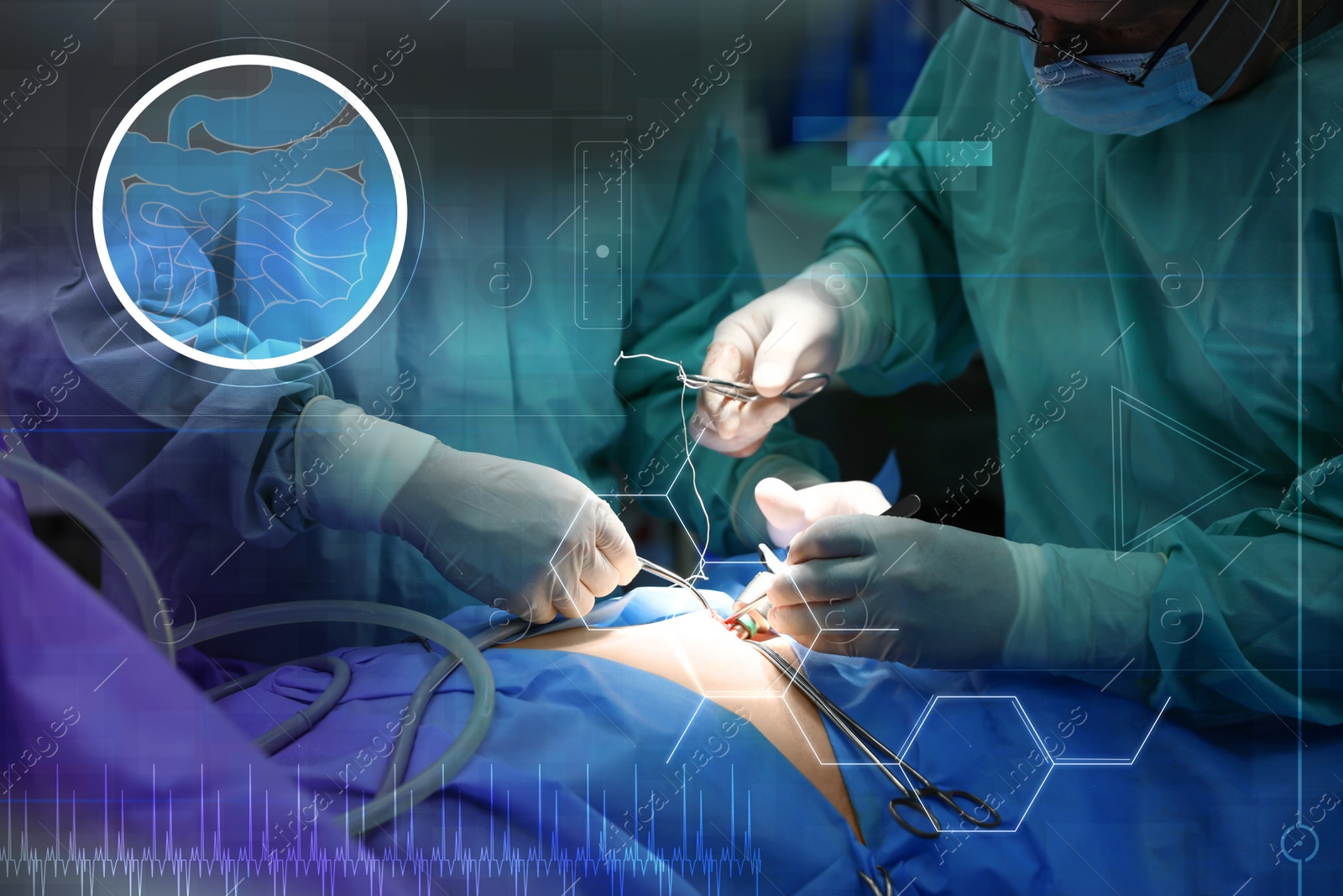 Image of Team of professional doctors performing operation in surgery room and illustration of different virtual icons