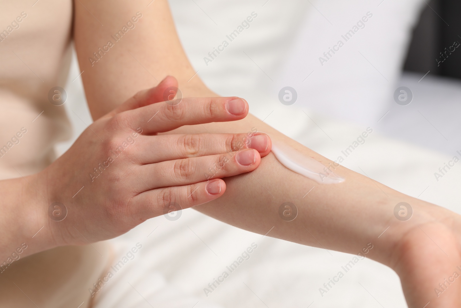 Photo of Young woman with dry skin applying cream onto her arm indoors, closeup