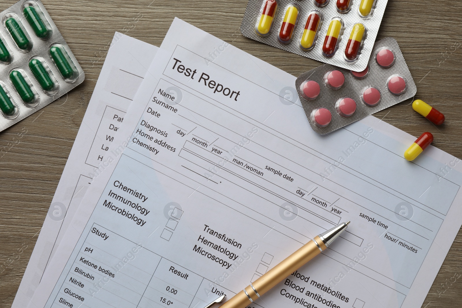 Photo of Drug test result form, pills and pen on wooden table, flat lay