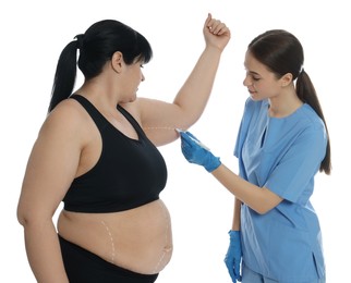 Photo of Doctor drawing marks on obese woman's body against white background. Weight loss surgery