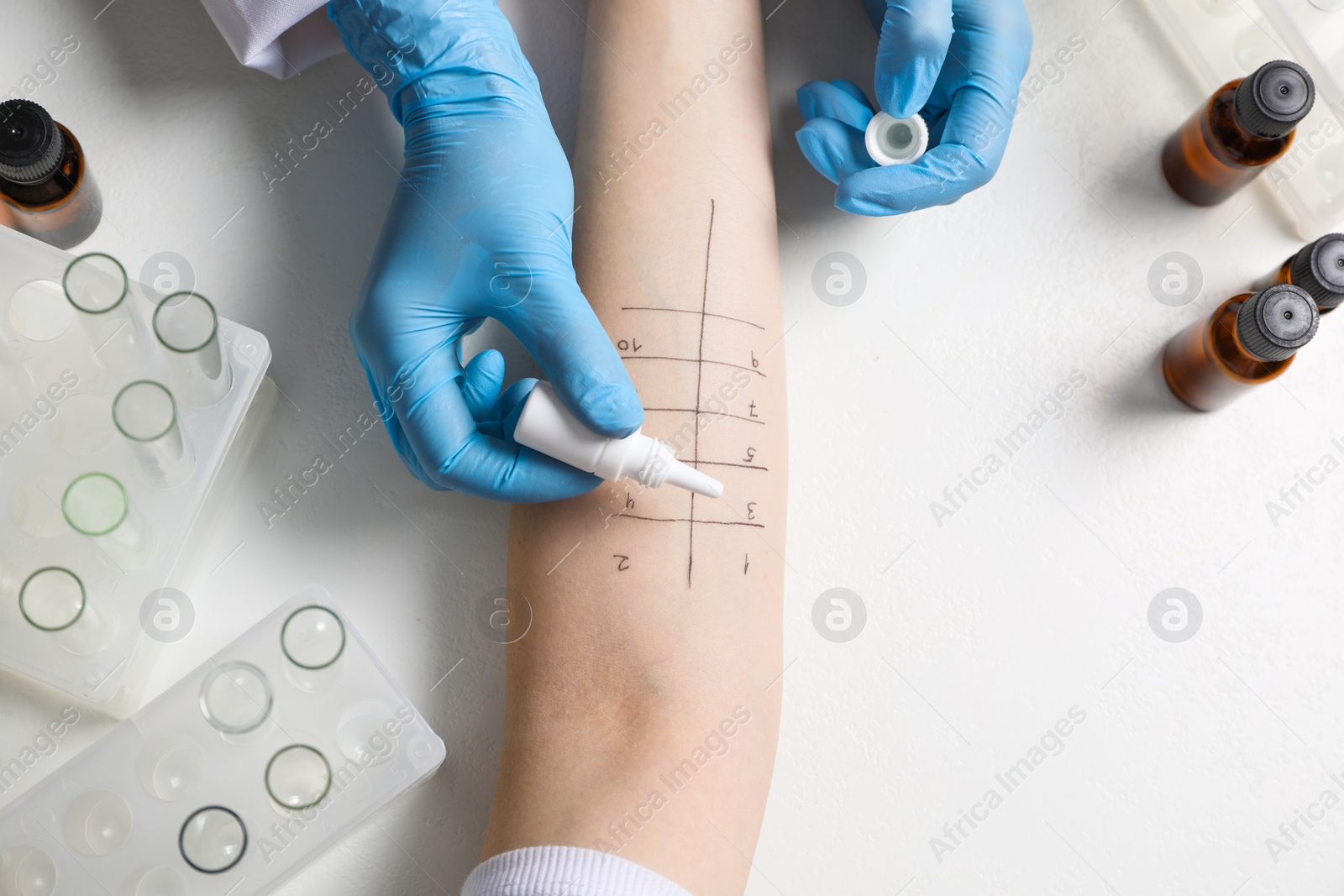 Photo of Doctor doing skin allergy test at light table, top view