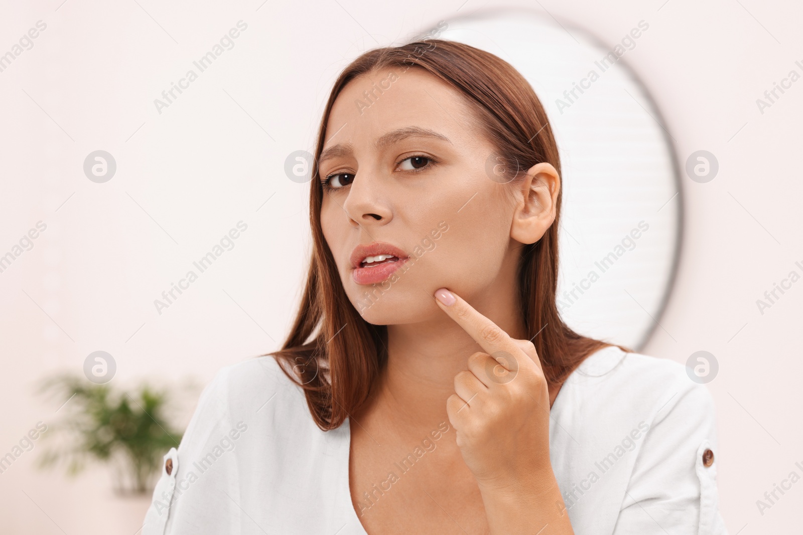 Photo of Woman with skin problem indoors, view from mirror