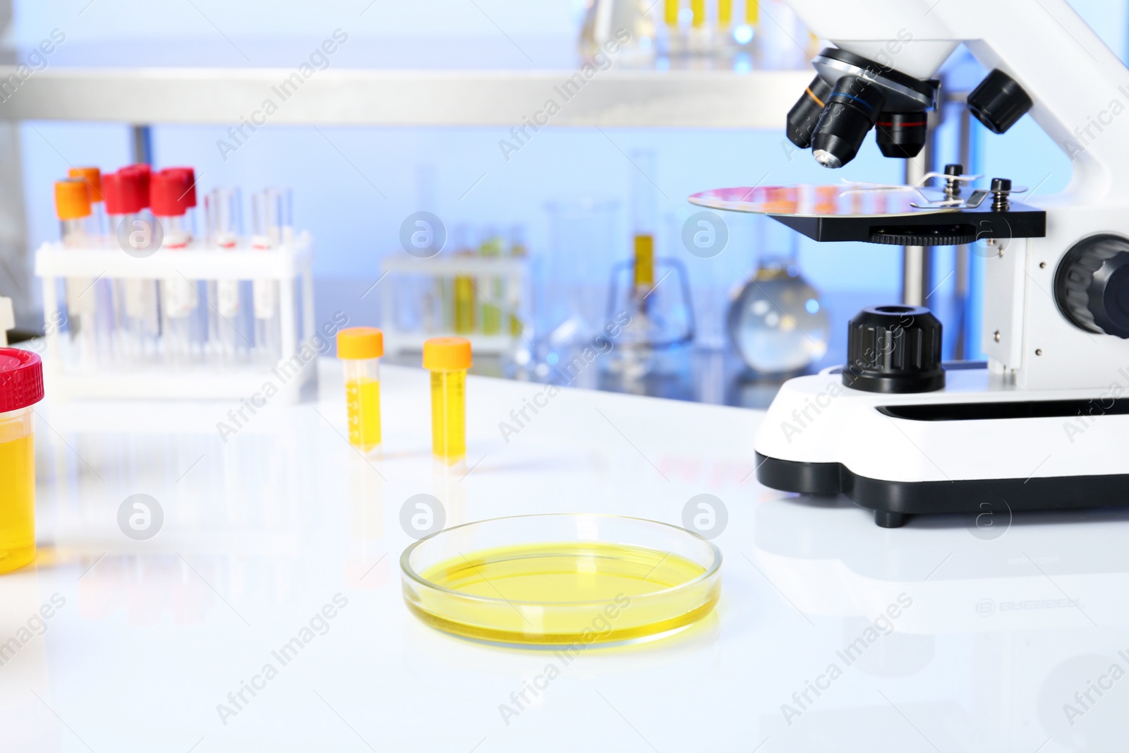 Photo of Petri dish with urine sample for analysis and microscope on table in laboratory