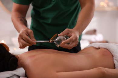 Therapist giving fire cupping treatment to patient indoors, closeup