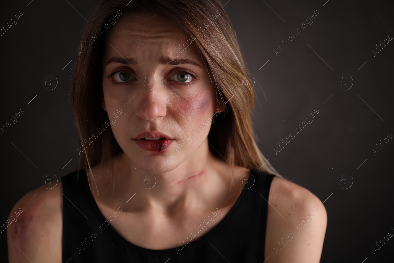 Photo of Woman with facial injuries on black background. Domestic violence victim