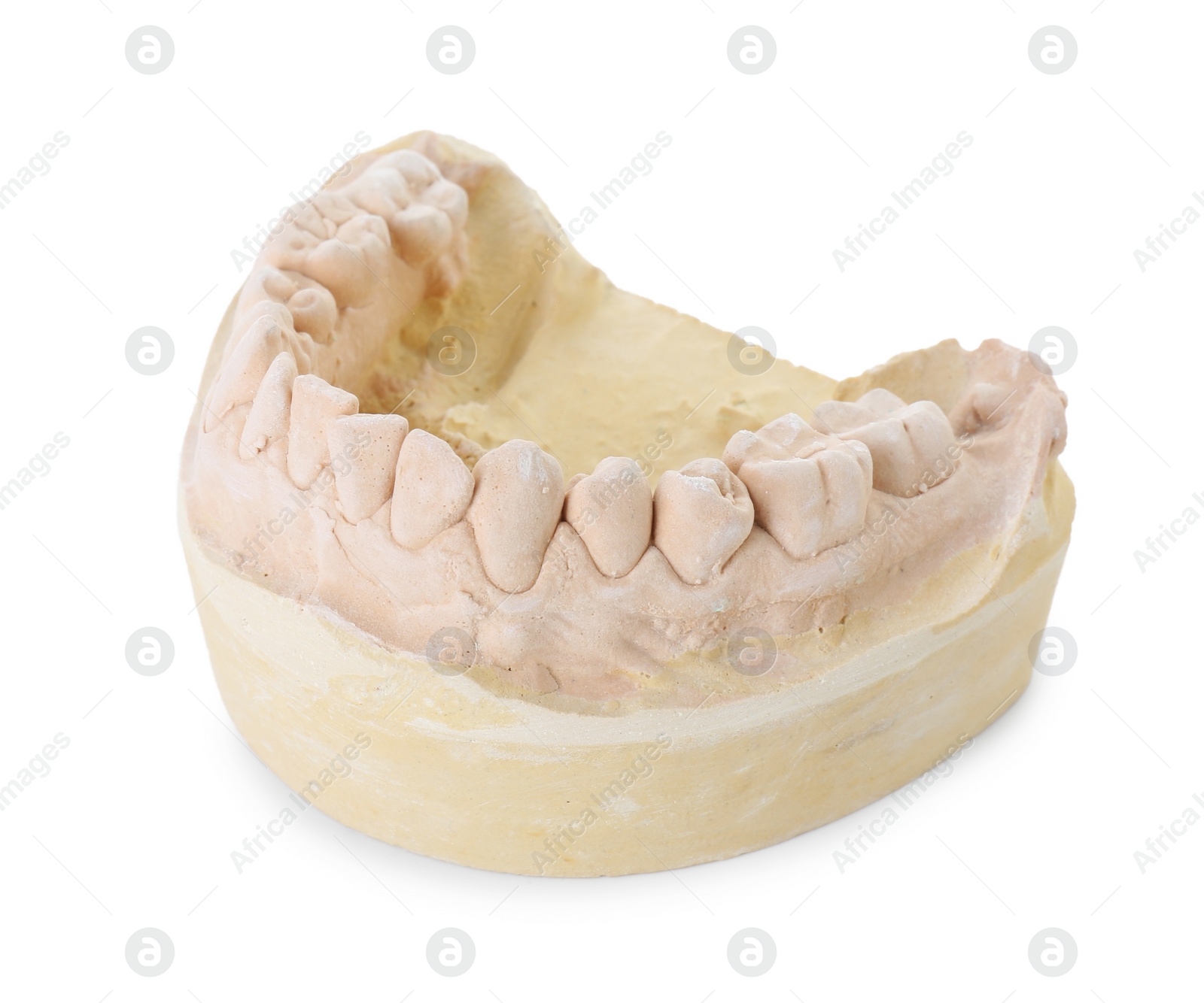 Photo of Dental model with jaw isolated on white. Cast of teeth