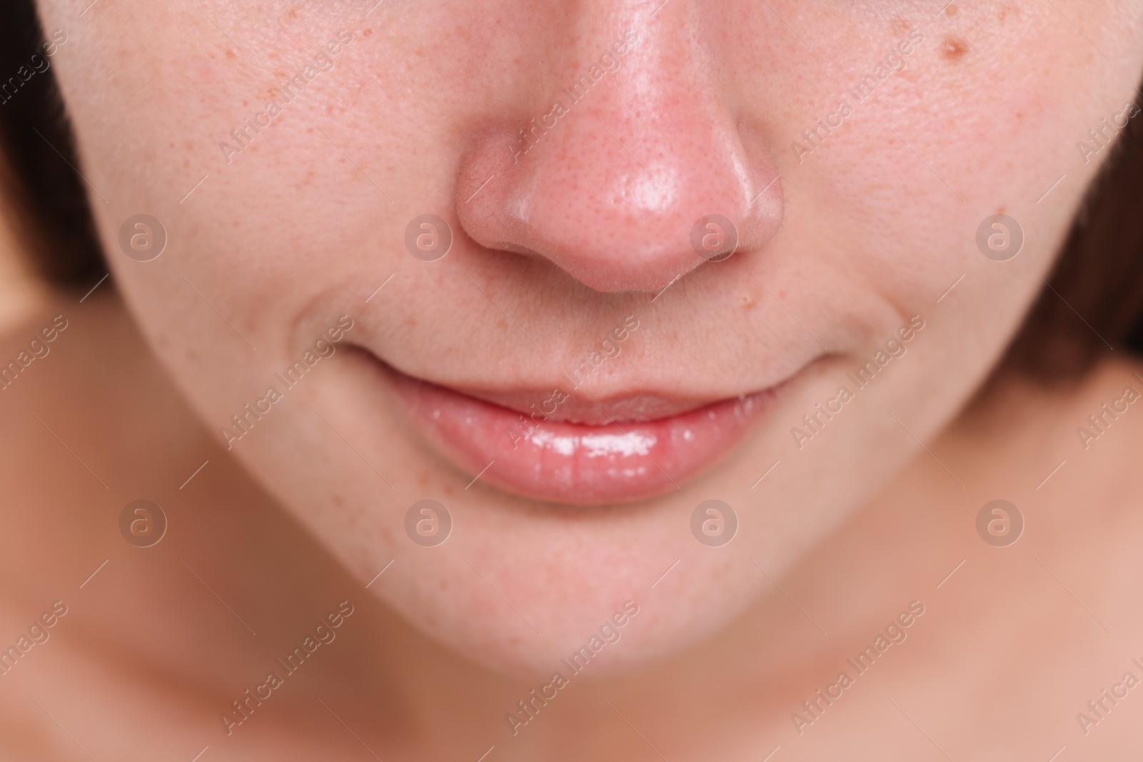 Photo of Closeup view of woman with blackheads on her nose