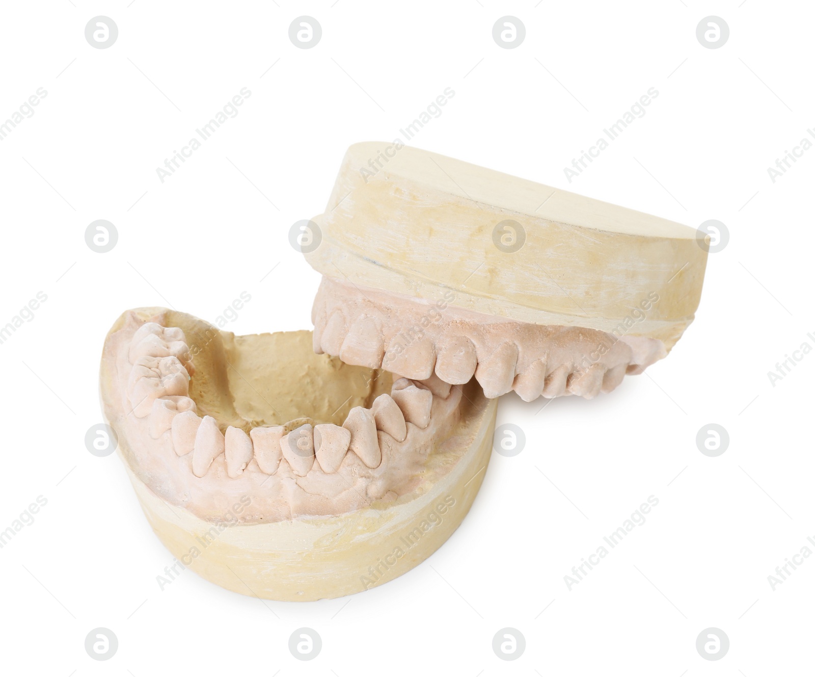 Photo of Dental model with jaws isolated on white. Cast of teeth