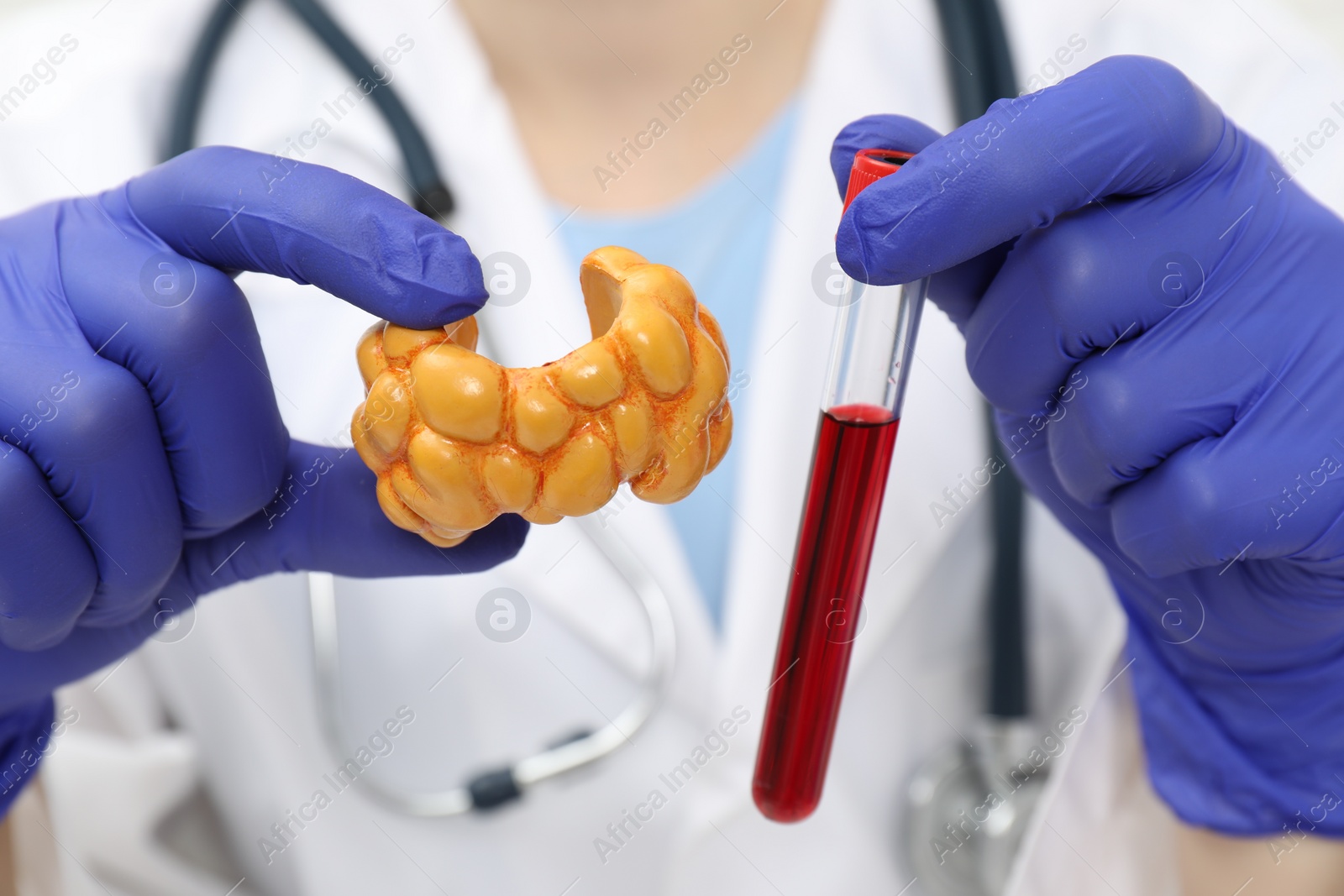 Photo of Endocrinologist showing thyroid gland model and blood sample in test tube, closeup