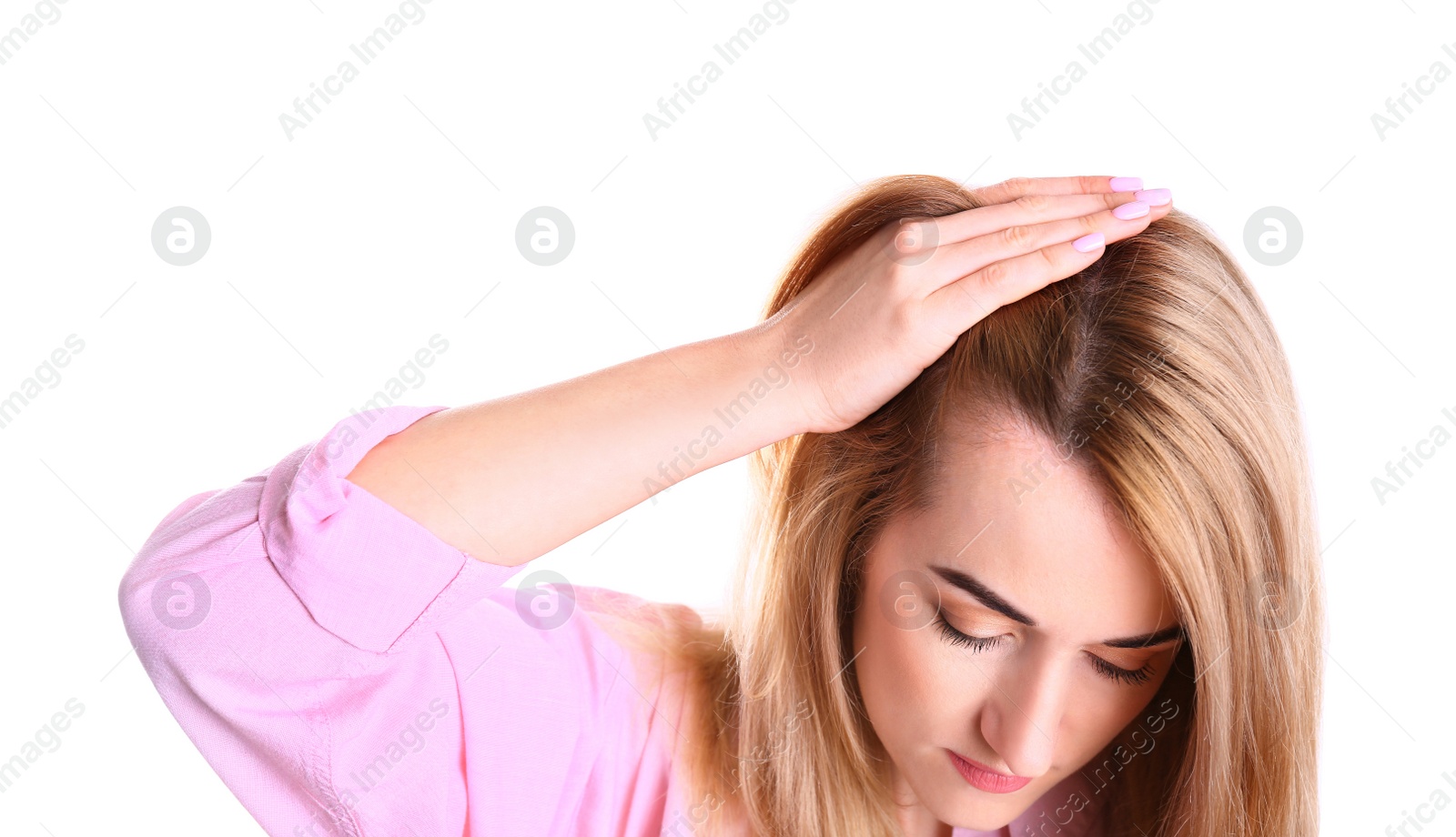 Photo of Young woman with hair loss problem on white background