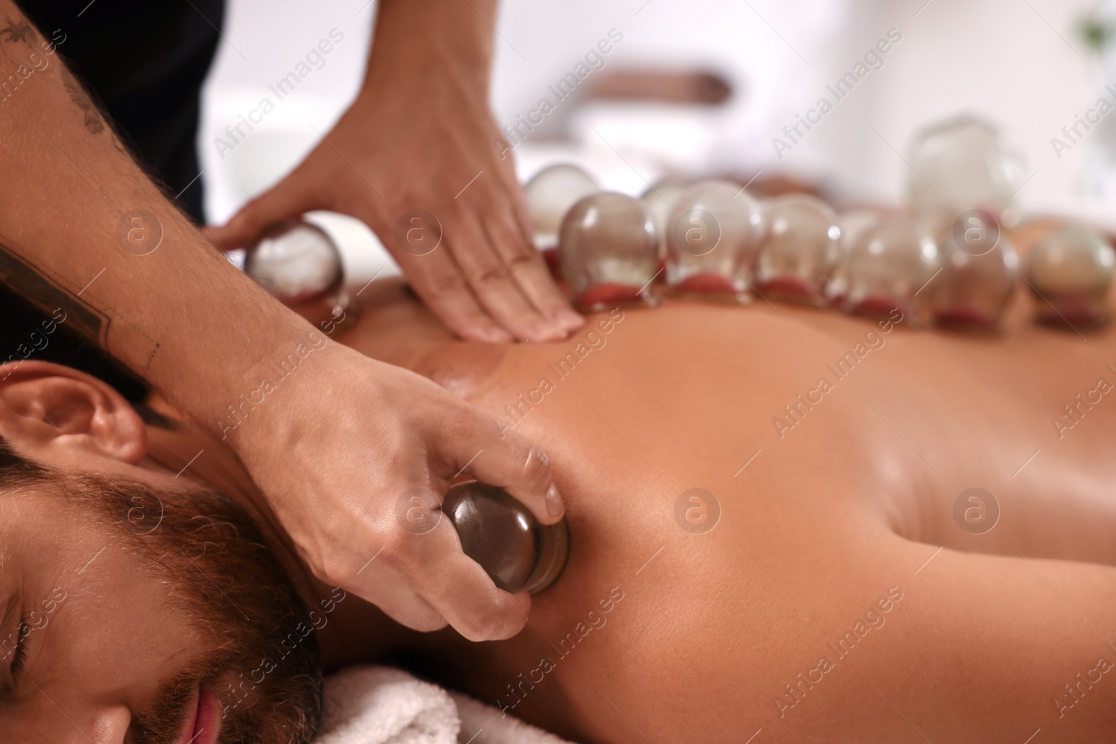 Photo of Therapist giving cupping treatment to patient indoors, closeup