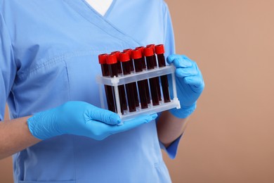 Photo of Laboratory testing. Doctor with blood samples in tubes on light brown background, closeup