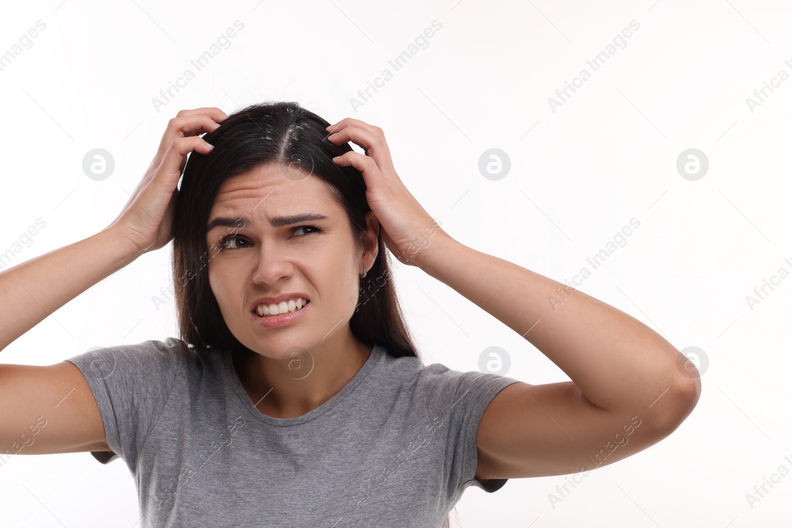 Photo of Emotional woman examining her hair and scalp on white background. Dandruff problem