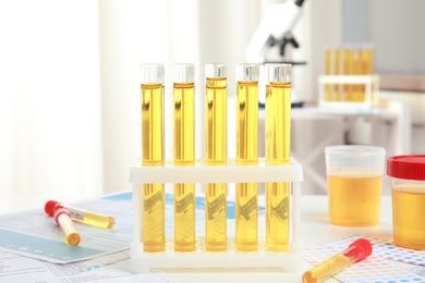Photo of Test tubes with urine samples for analysis on white table in laboratory