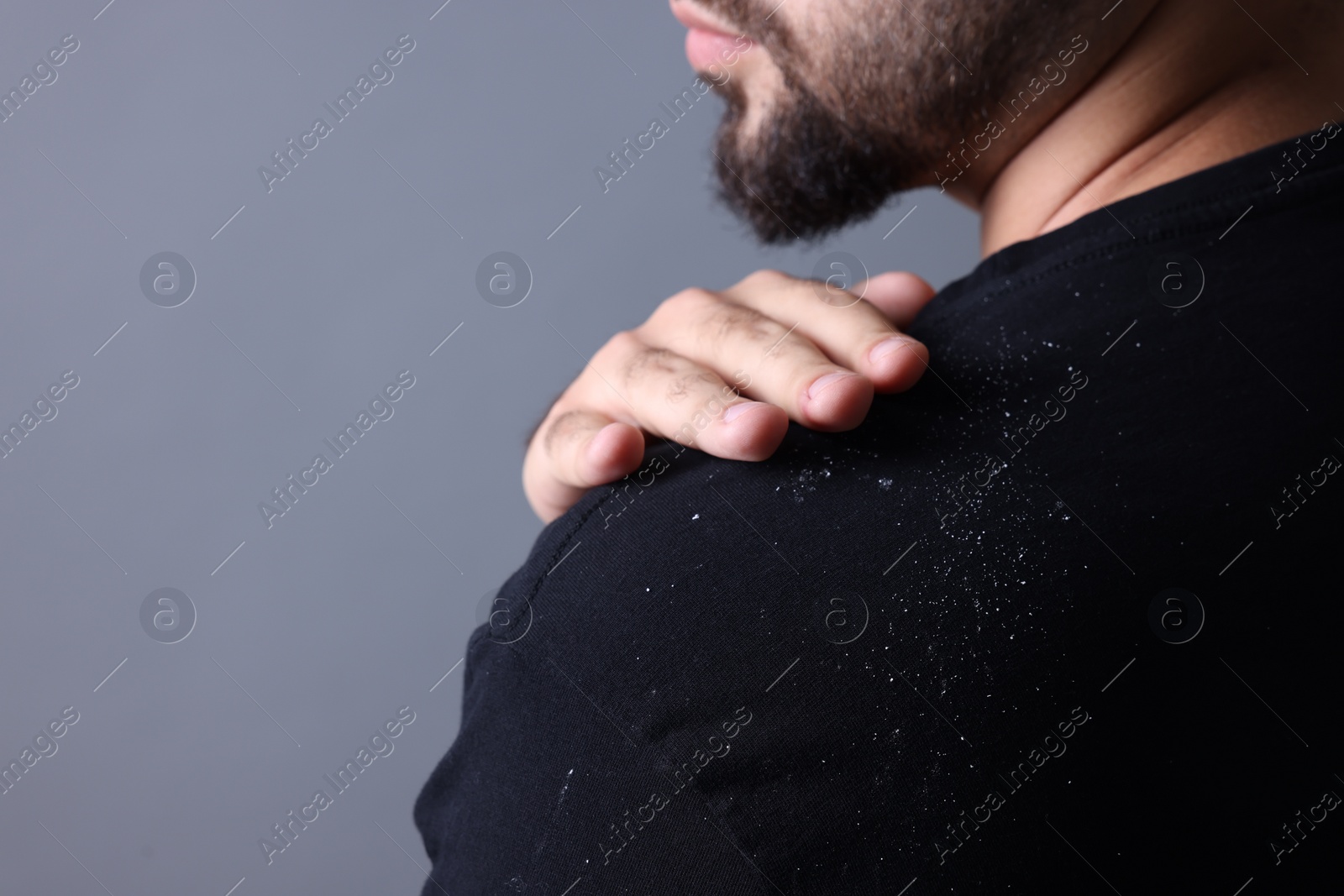 Photo of Man brushing dandruff off his sweater on grey background, closeup. Space for text