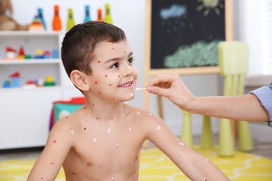 Photo of Woman applying cream onto skin of little boy with chickenpox at home