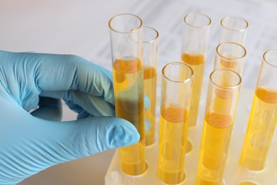 Photo of Nurse holding tube with urine sample for analysis on blurred background, closeup