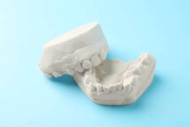 Dental model with gums on light blue background. Cast of teeth