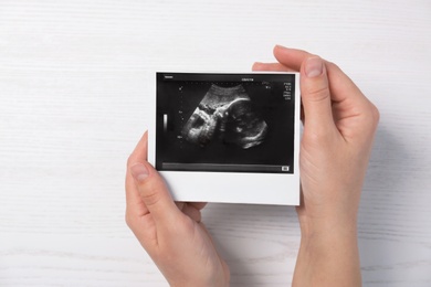 Photo of Woman holding ultrasound photo of baby over table, top view