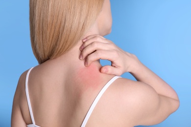 Woman with allergy symptoms scratching neck on color background, closeup