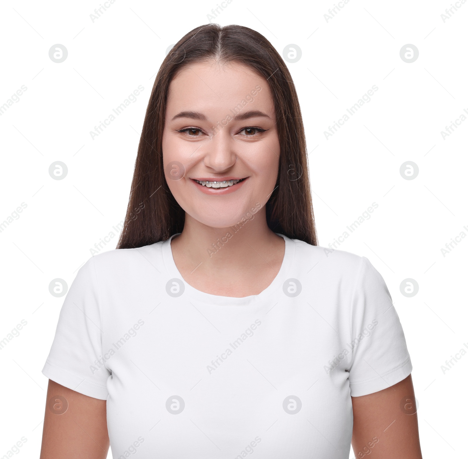 Photo of Smiling woman with dental braces on white background