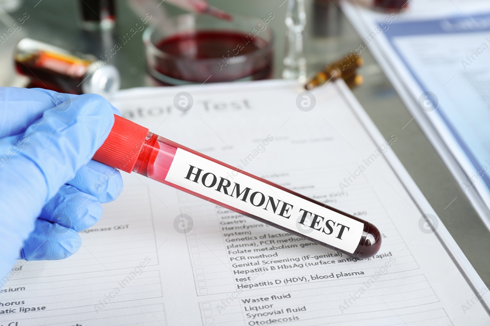 Photo of Doctor holding glass tube with blood sample and label Hormone Test at table, closeup