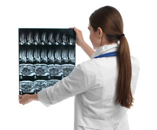 Orthopedist holding X-ray picture on white background