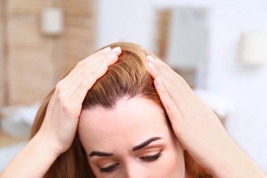Photo of Young woman with hair loss problem on blurred background, closeup
