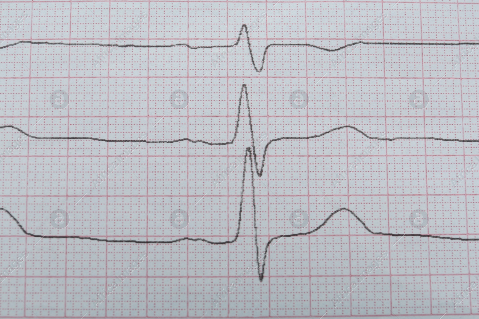 Photo of Cardiogram report as background, closeup. Heart diagnosis