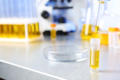 Dripping urine sample from pipette into container on table in laboratory, space for text. Medical analysis